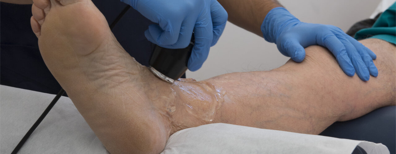 ultrasound Deerfield Beach